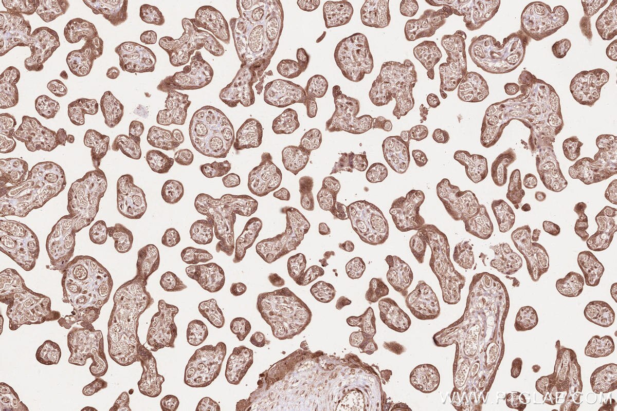 Immunohistochemical analysis of paraffin-embedded human placenta tissue slide using KHC2609 (LARP4 IHC Kit).