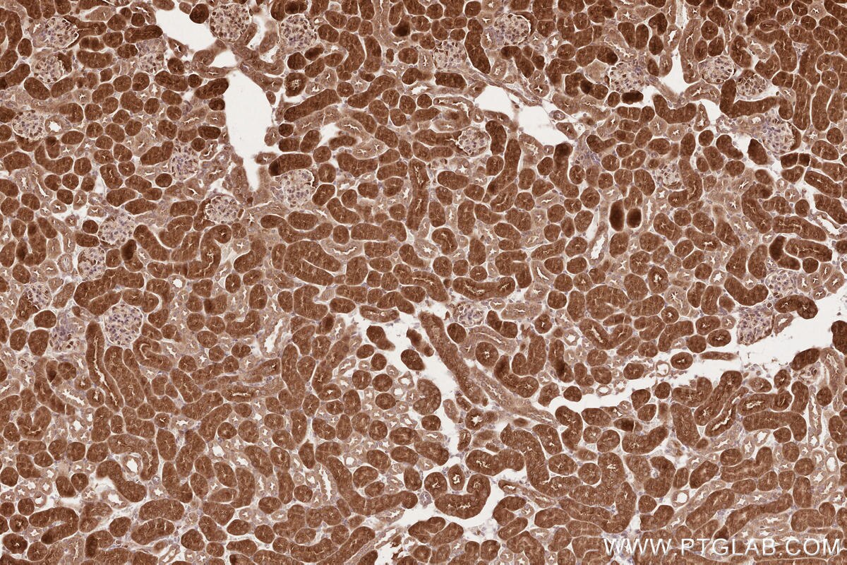 Immunohistochemical analysis of paraffin-embedded mouse kidney tissue slide using KHC2609 (LARP4 IHC Kit).