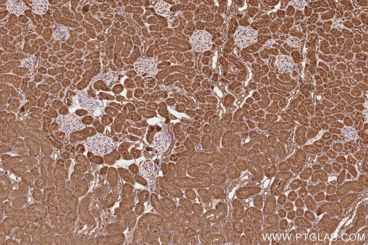 Immunohistochemical analysis of paraffin-embedded rat kidney tissue slide using KHC2609 (LARP4 IHC Kit).