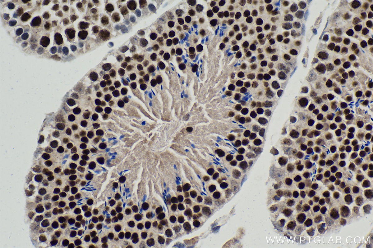 Immunohistochemical analysis of paraffin-embedded mouse testis tissue slide using KHC1771 (LARP7 IHC Kit).