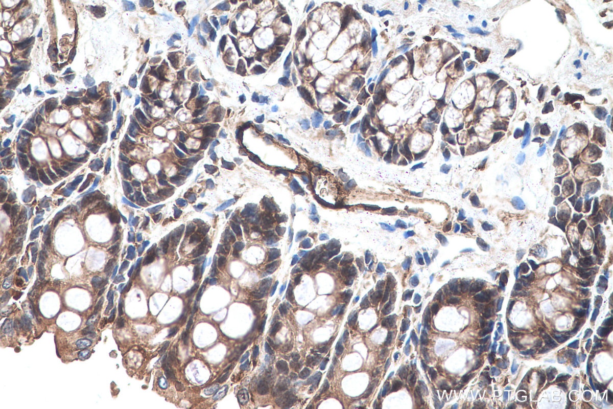 Immunohistochemical analysis of paraffin-embedded rat colon tissue slide using KHC0676 (LASP1 IHC Kit).