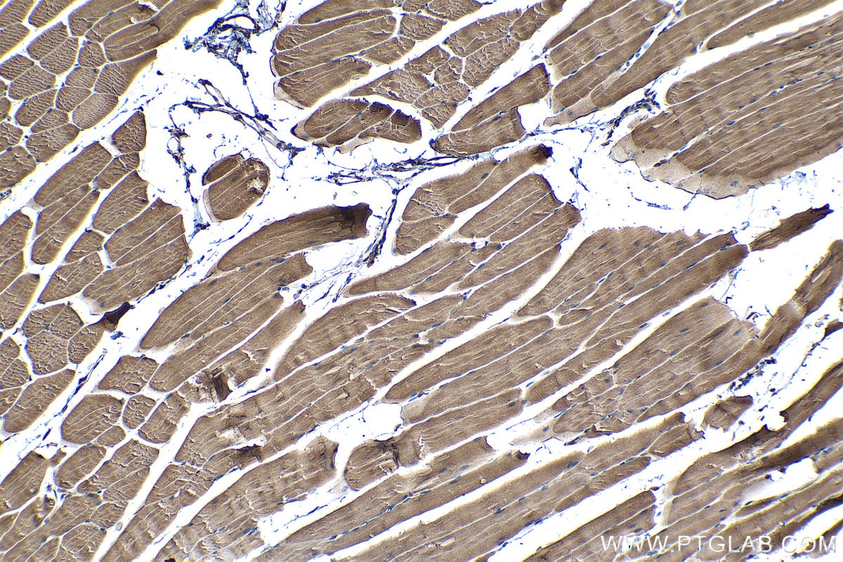 Immunohistochemical analysis of paraffin-embedded mouse skeletal muscle tissue slide using KHC1245 (LATS2 IHC Kit).