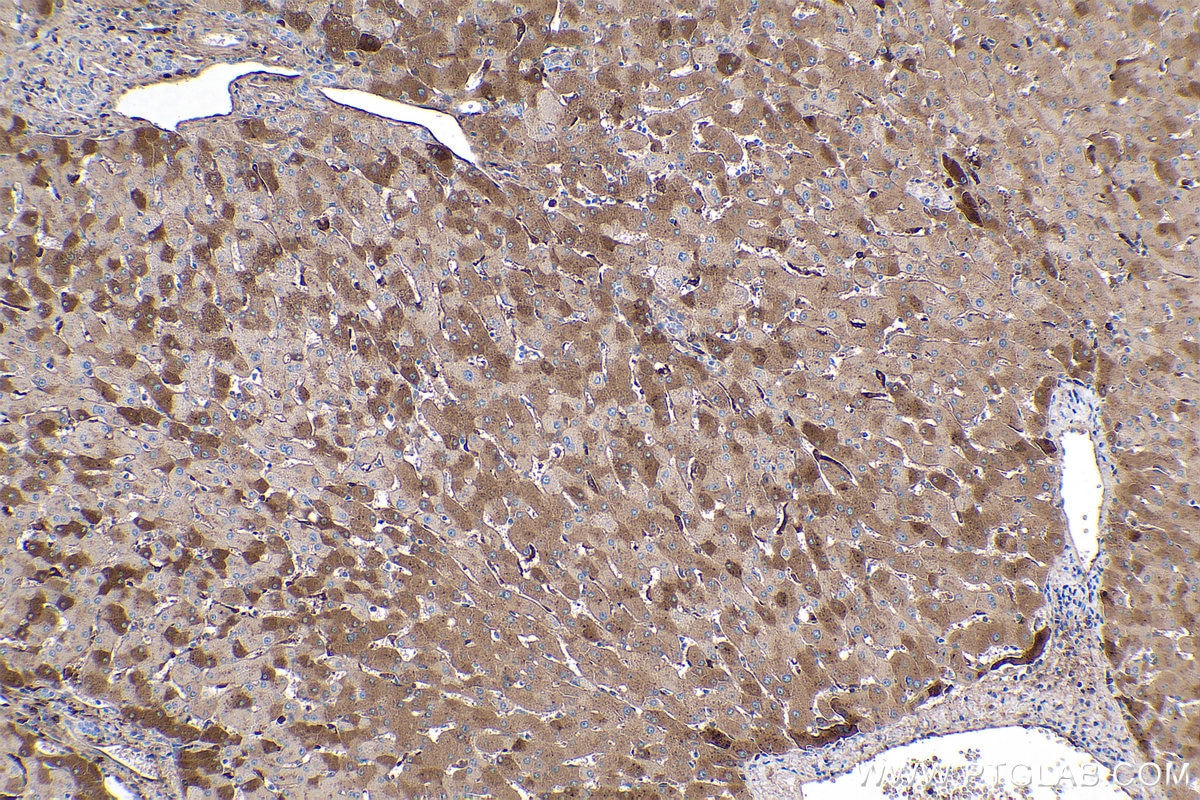 Immunohistochemical analysis of paraffin-embedded human liver tissue slide using KHC0432 (LBP IHC Kit).