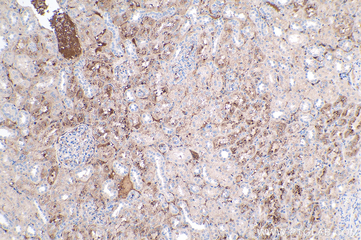 Immunohistochemical analysis of paraffin-embedded human kidney tissue slide using KHC0432 (LBP IHC Kit).