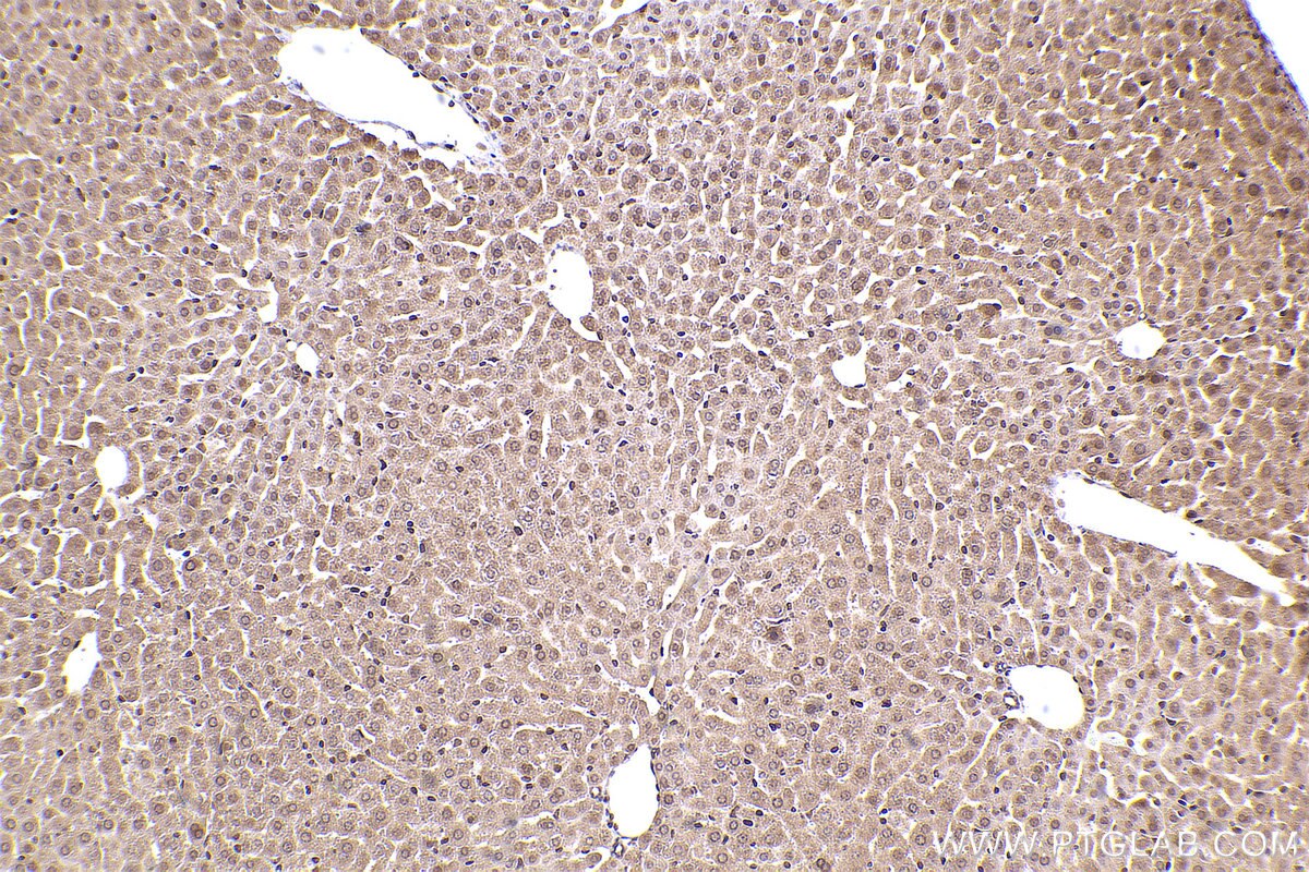 Immunohistochemical analysis of paraffin-embedded mouse liver tissue slide using KHC2467 (LBR IHC Kit).