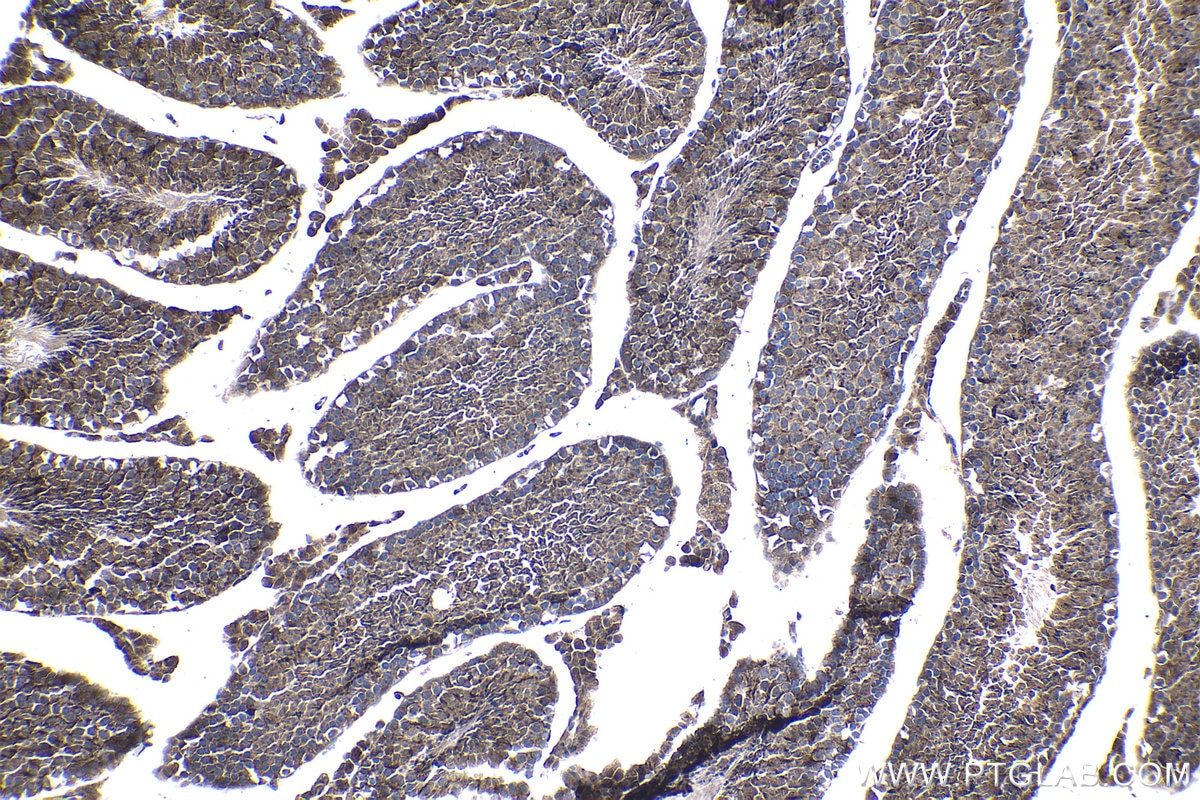 Immunohistochemical analysis of paraffin-embedded mouse testis tissue slide using KHC0940 (LC3 IHC Kit).