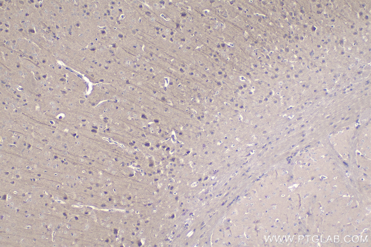 Immunohistochemical analysis of paraffin-embedded mouse brain tissue slide using KHC0939 (LC3A/B IHC Kit).