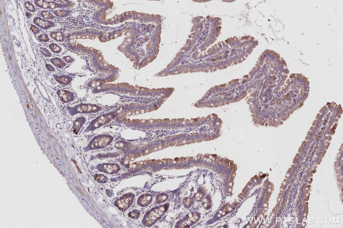 Immunohistochemical analysis of paraffin-embedded rat small intestine tissue slide using KHC3012 (LCMT1 IHC Kit). Immunohistochemical analysis of paraffin-embedded rat small intestine tissue slide using KHC3012 (LCMT1 IHC Kit).