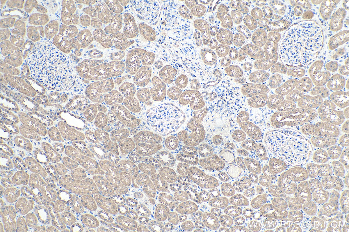 Immunohistochemical analysis of paraffin-embedded human kidney tissue slide using KHC0324 (LDHB IHC Kit).