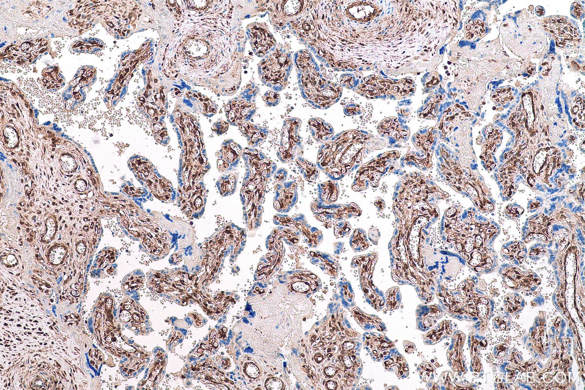 Immunohistochemical analysis of paraffin-embedded human placenta tissue slide using KHC0826 (LGALS1 IHC Kit).