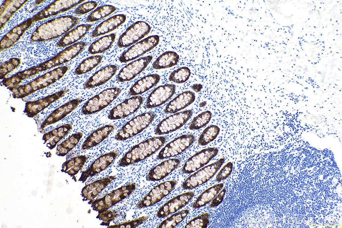 Immunohistochemical analysis of paraffin-embedded human colon tissue slide using KHC0671 (LGALS4 IHC Kit).