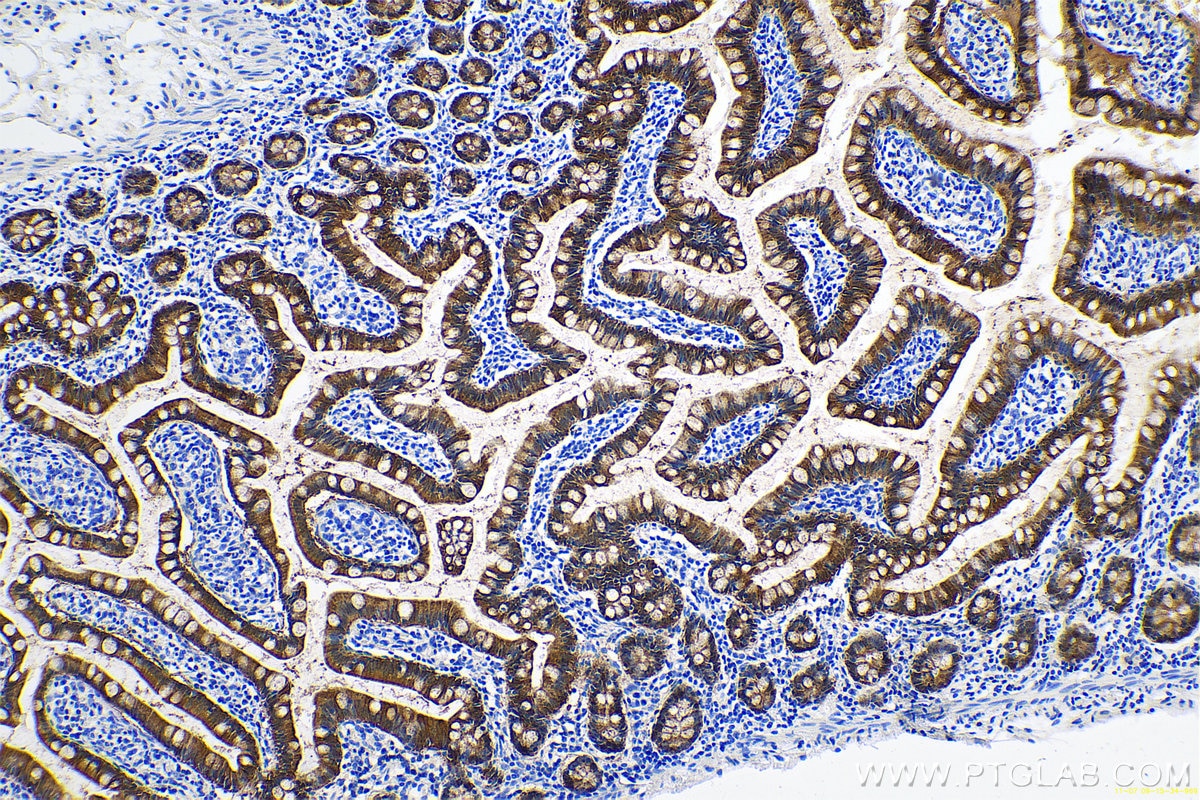 Immunohistochemical analysis of paraffin-embedded human small intestine tissue slide using KHC0671 (LGALS4 IHC Kit).