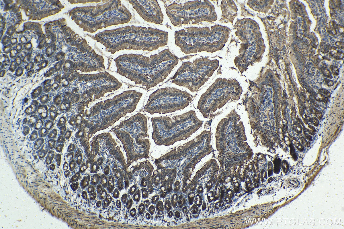 Immunohistochemical analysis of paraffin-embedded mouse small intestine tissue slide using KHC1418 (LGALS9 IHC Kit).