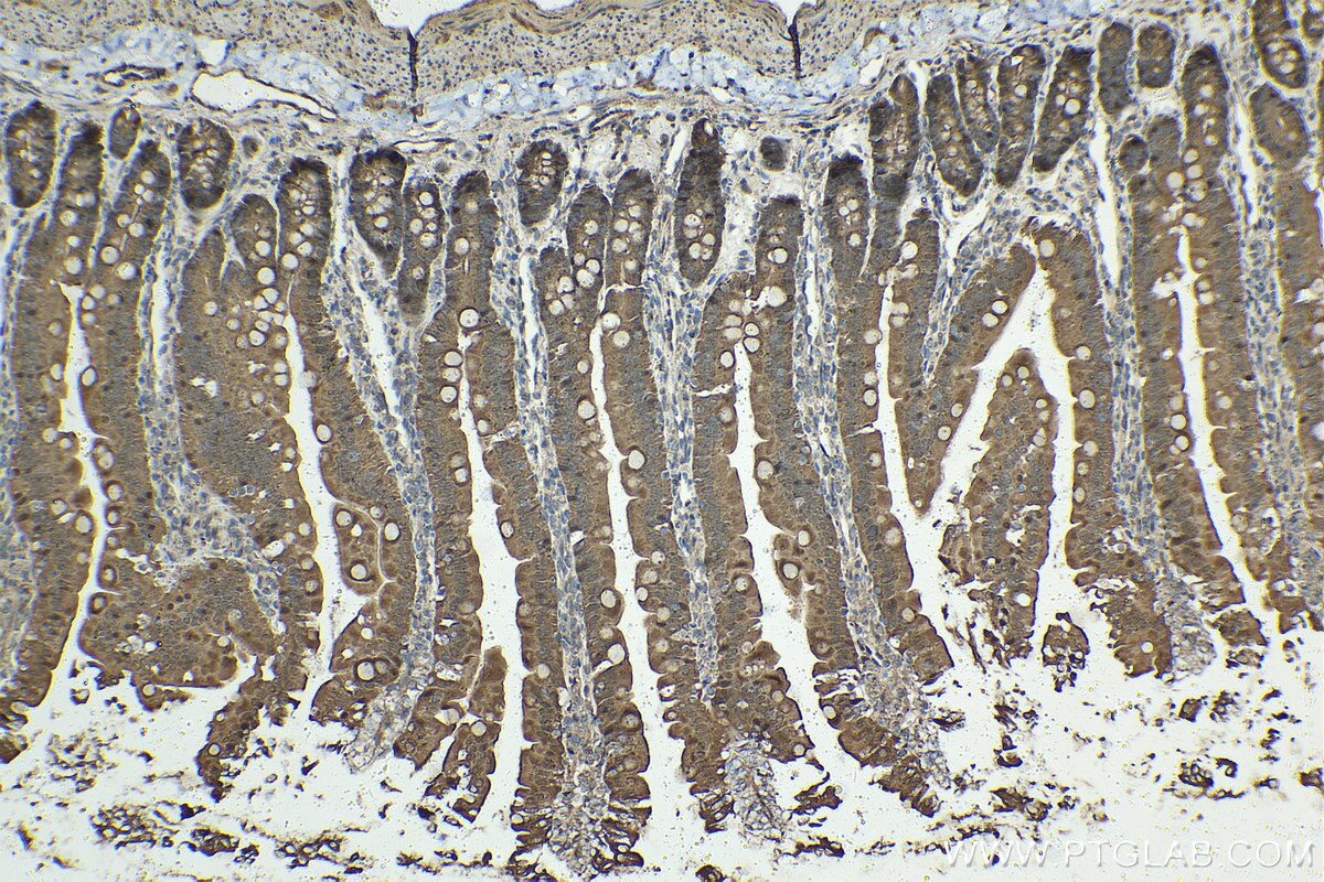 Immunohistochemical analysis of paraffin-embedded rat small intestine tissue slide using KHC1418 (LGALS9 IHC Kit).