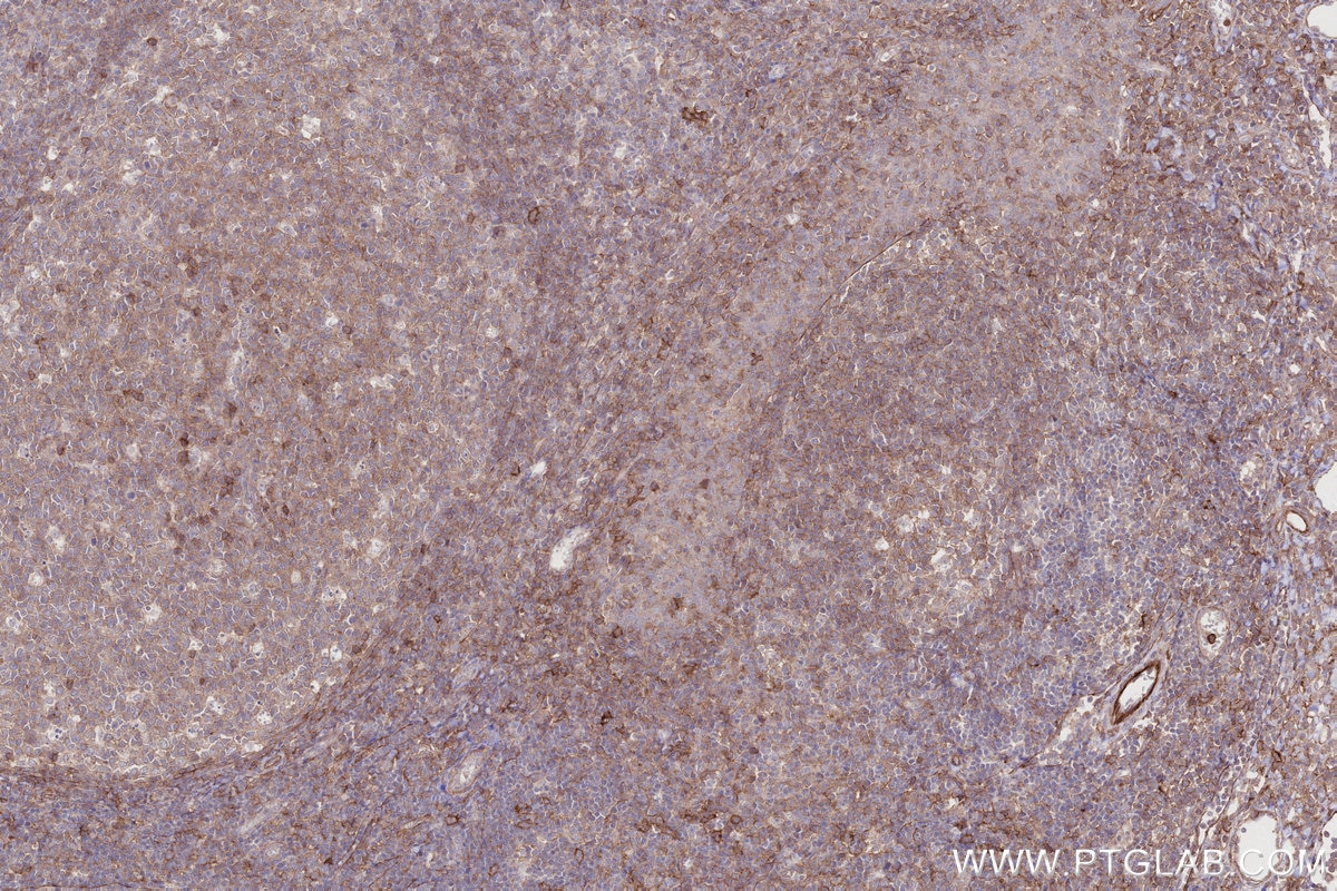 Immunohistochemical analysis of paraffin-embedded human tonsillitis tissue slide using KHC2699 (LILRB1 IHC Kit).