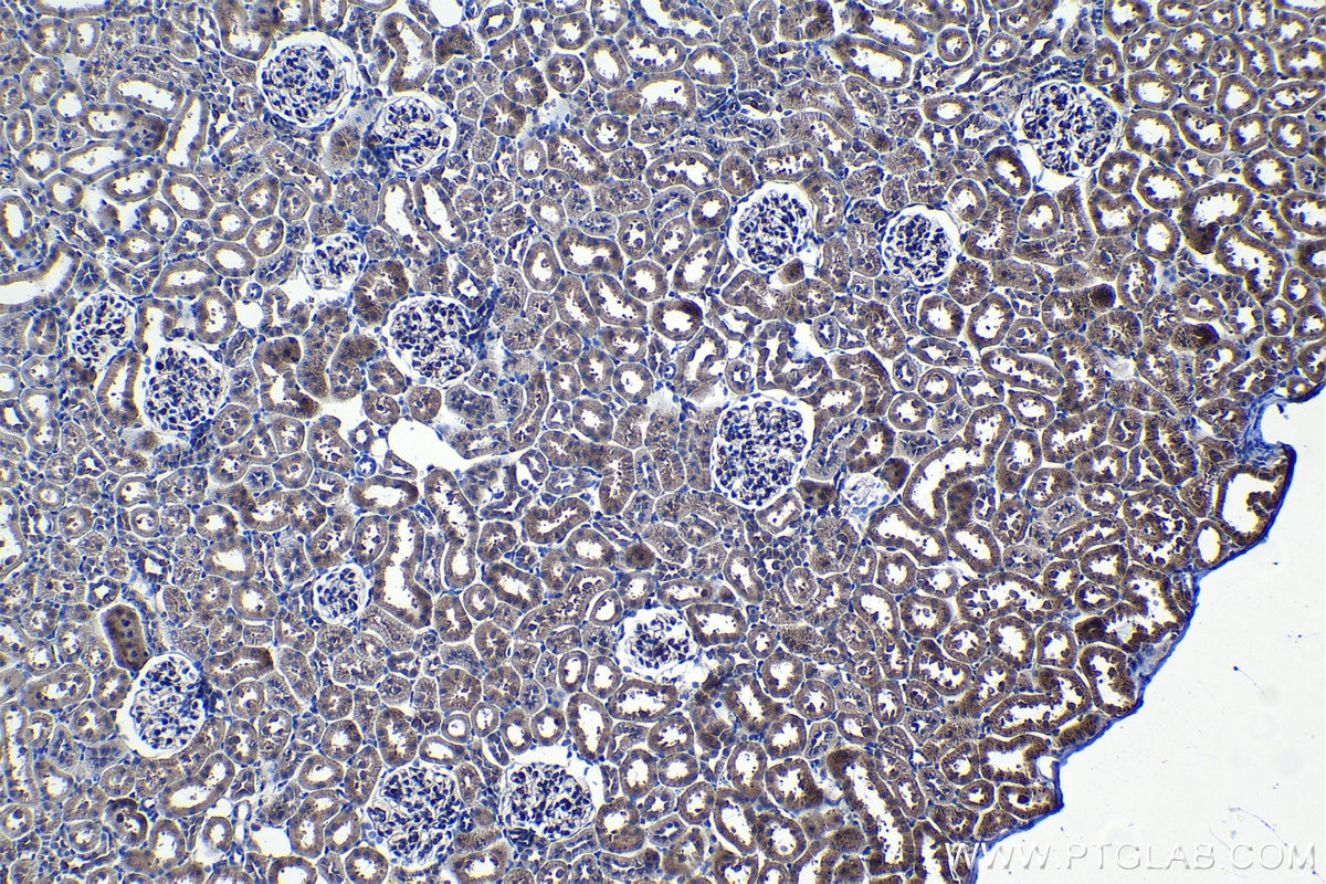 Immunohistochemical analysis of paraffin-embedded rat kidney tissue slide using KHC1180 (LIMCH1 IHC Kit).