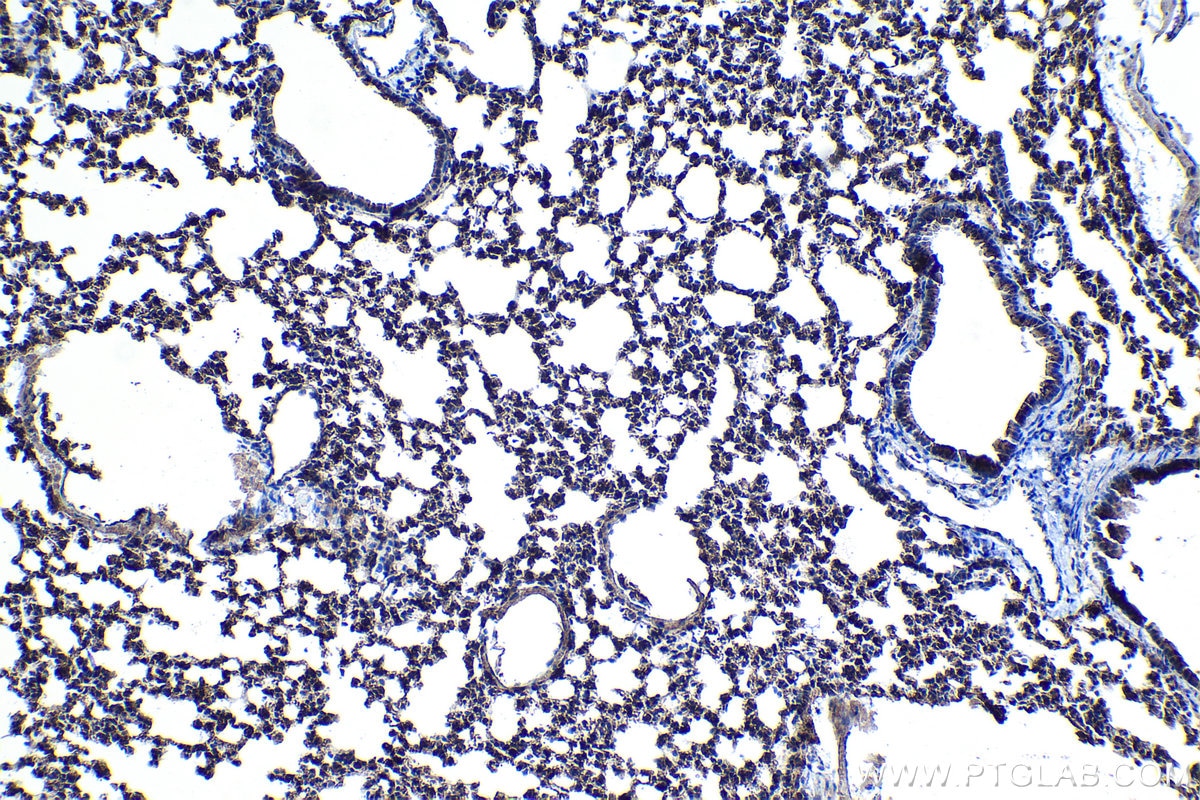 Immunohistochemical analysis of paraffin-embedded mouse lung tissue slide using KHC1180 (LIMCH1 IHC Kit).