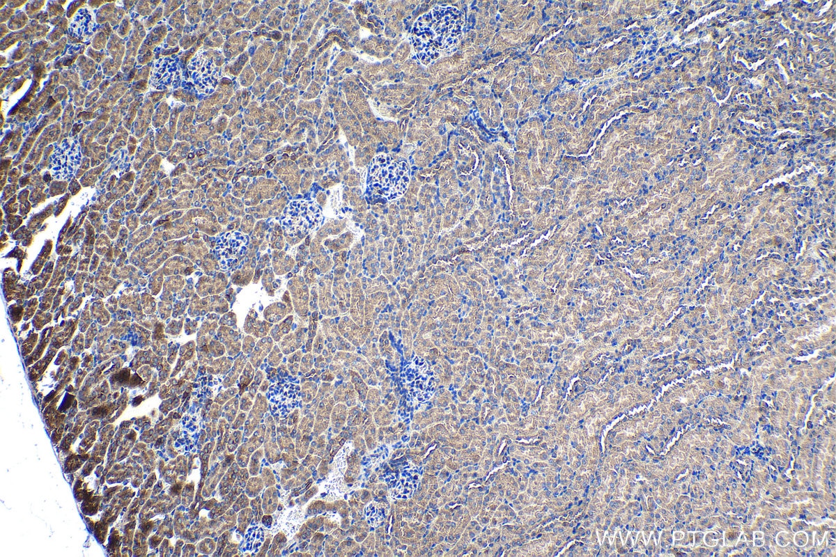 Immunohistochemical analysis of paraffin-embedded mouse kidney tissue slide using KHC1180 (LIMCH1 IHC Kit).