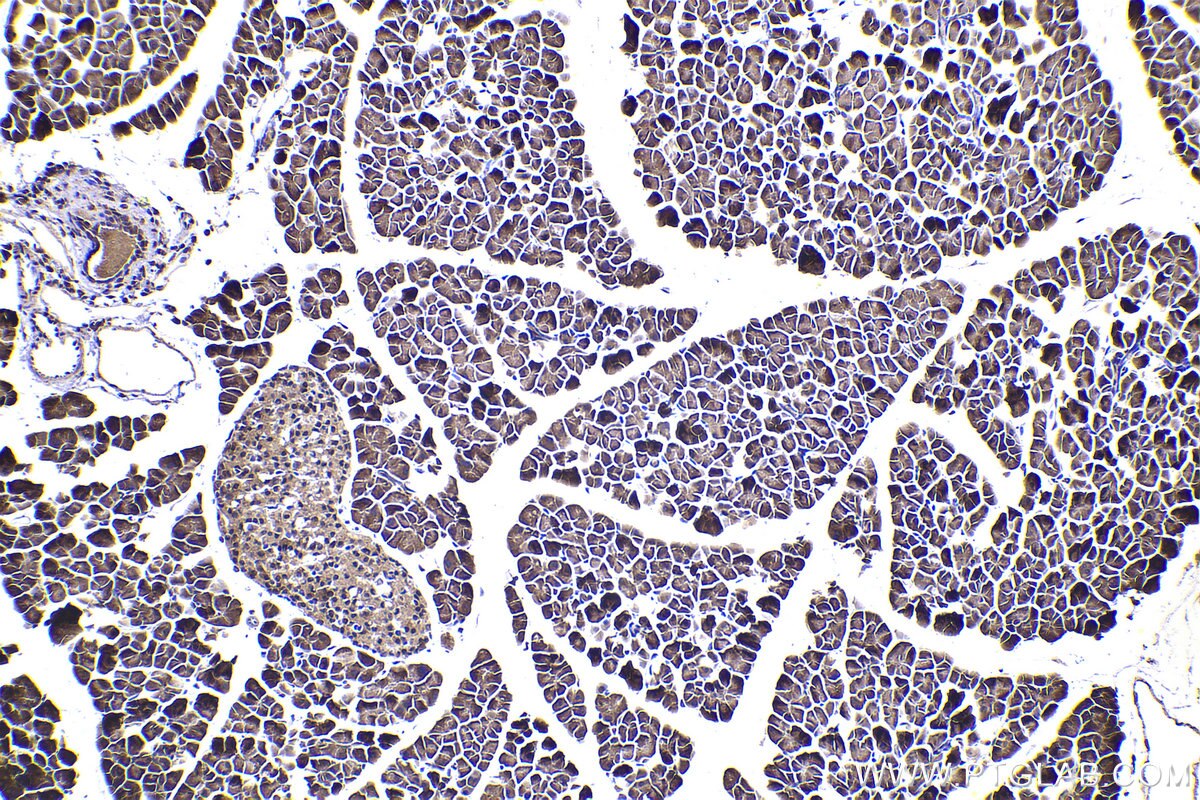 Immunohistochemical analysis of paraffin-embedded mouse pancreas tissue slide using KHC2318 (LIMK2 IHC Kit).