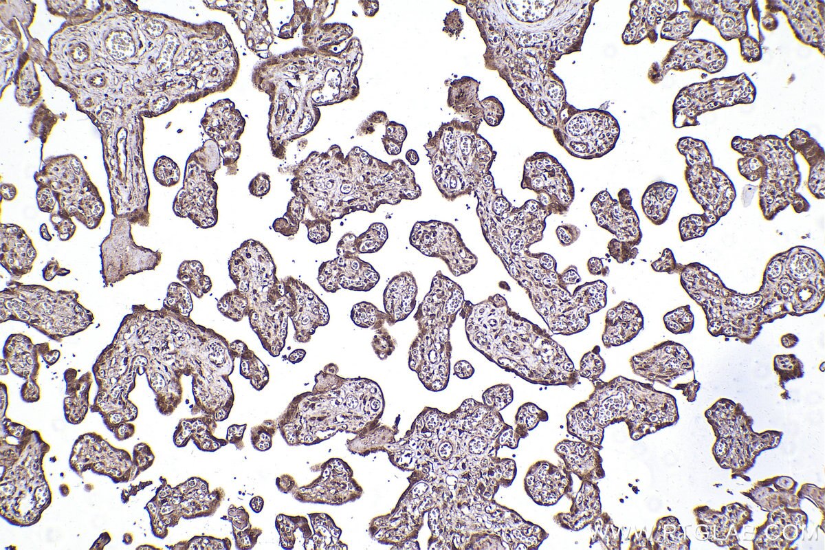 Immunohistochemical analysis of paraffin-embedded human placenta tissue slide using KHC2272 (LIS1 IHC Kit).