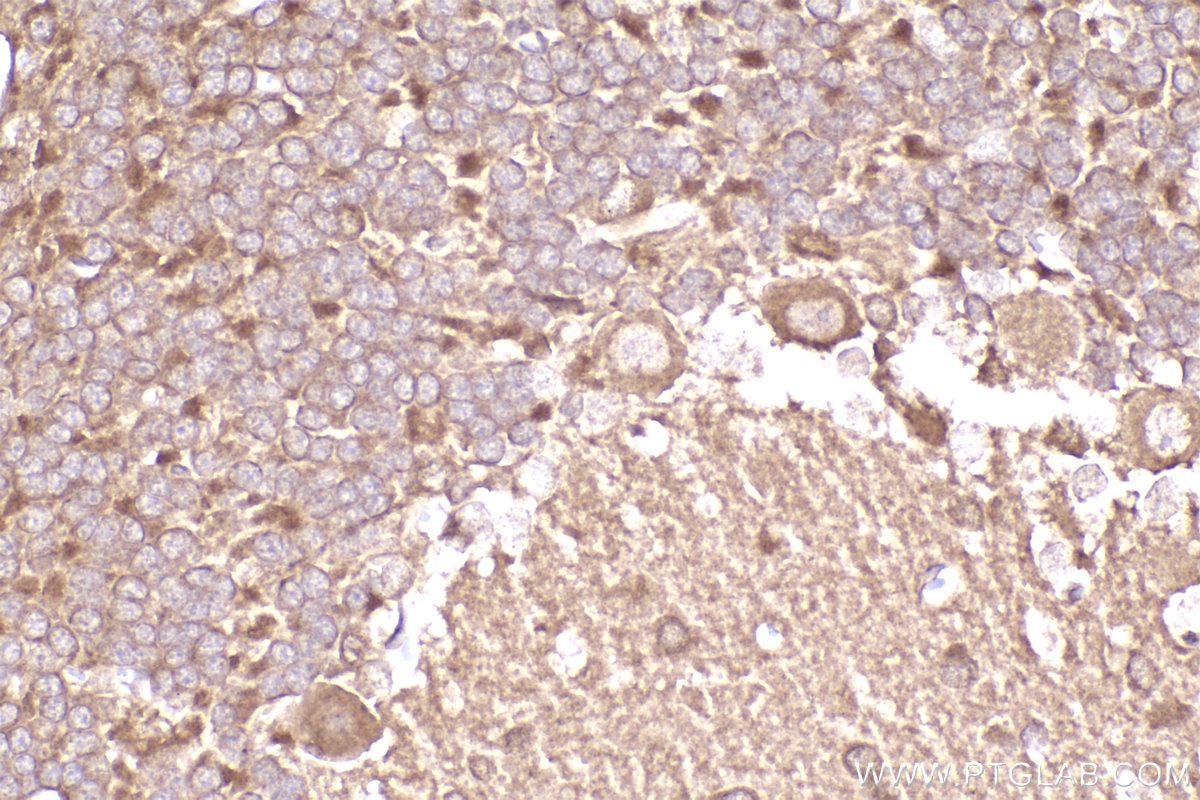 Immunohistochemical analysis of paraffin-embedded rat cerebellum tissue slide using KHC2272 (LIS1 IHC Kit).
