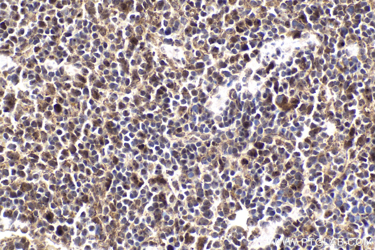 Immunohistochemical analysis of paraffin-embedded mouse spleen tissue slide using KHC1896 (LITAF IHC Kit).