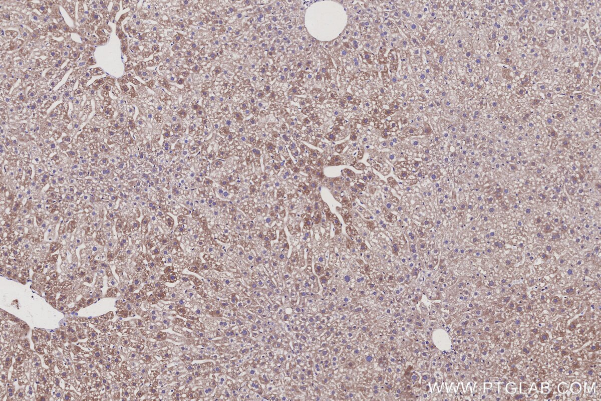 Immunohistochemical analysis of paraffin-embedded mouse liver tissue slide using KHC3116 (LMF2 IHC Kit). Immunohistochemical analysis of paraffin-embedded mouse liver tissue slide using KHC3116 (LMF2 IHC Kit).