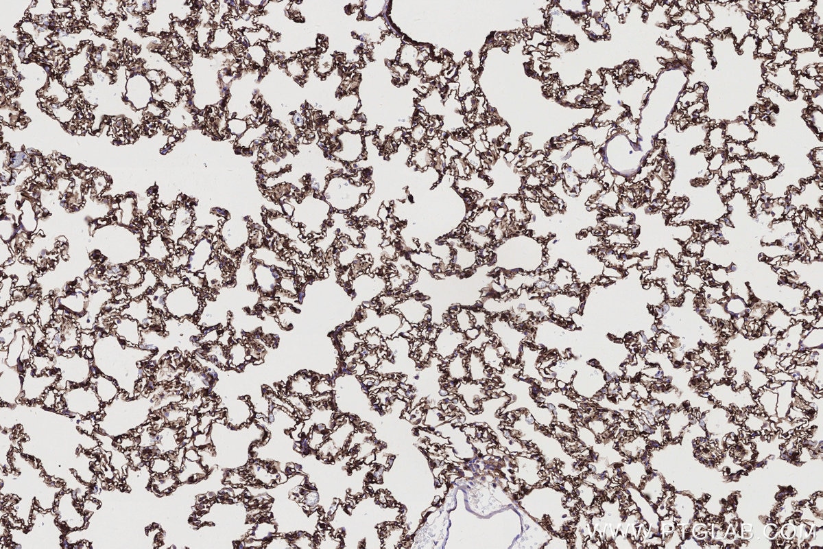 Immunohistochemical analysis of paraffin-embedded rat lung tissue slide using KHC2738 (LMO7 IHC Kit).