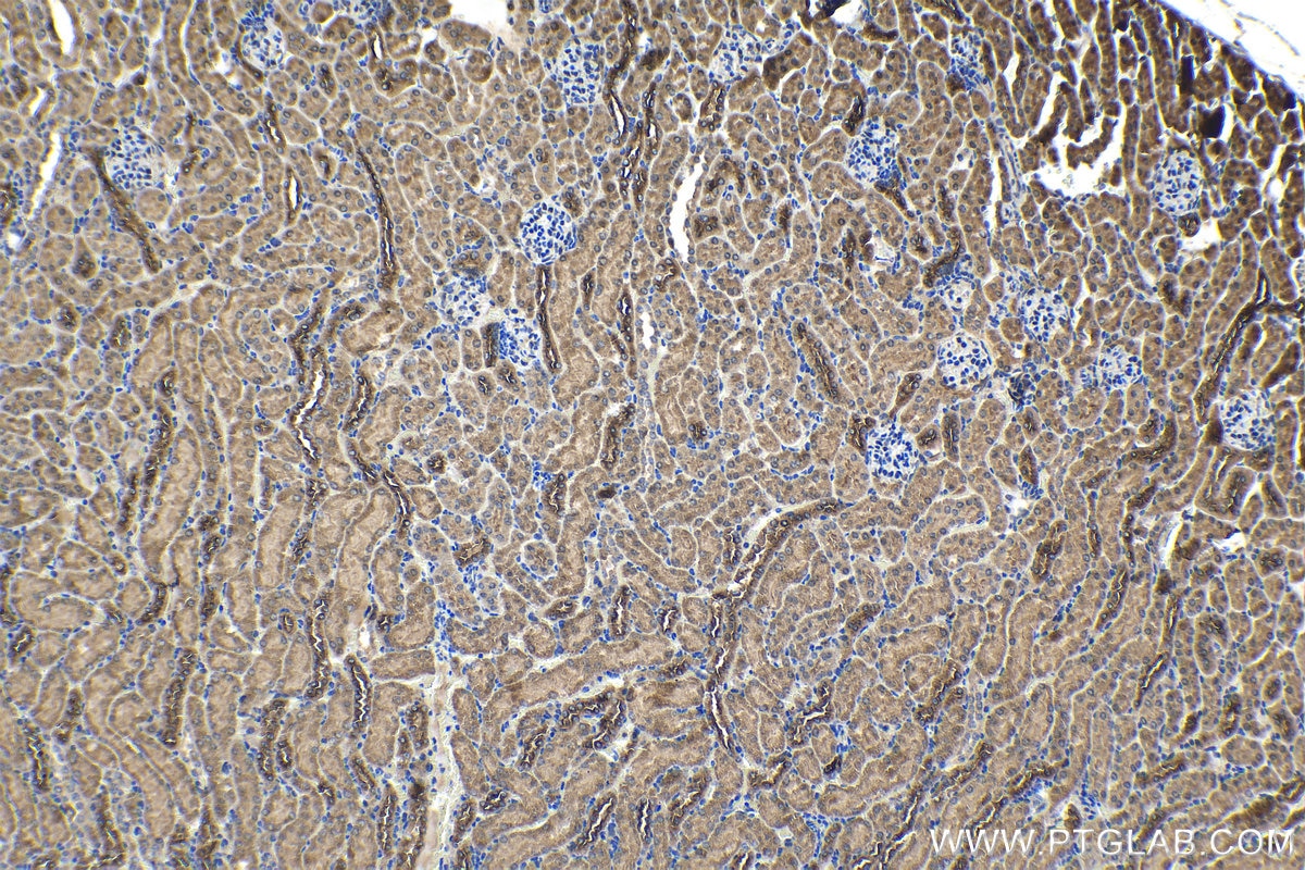 Immunohistochemical analysis of paraffin-embedded mouse kidney tissue slide using KHC1247 (LONP2 IHC Kit).