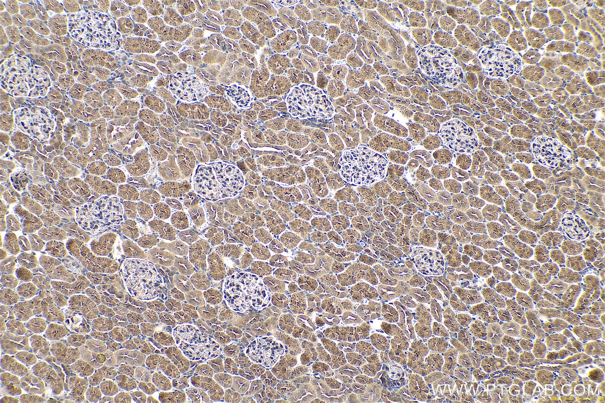 Immunohistochemical analysis of paraffin-embedded rat kidney tissue slide using KHC0630 (LOX IHC Kit).