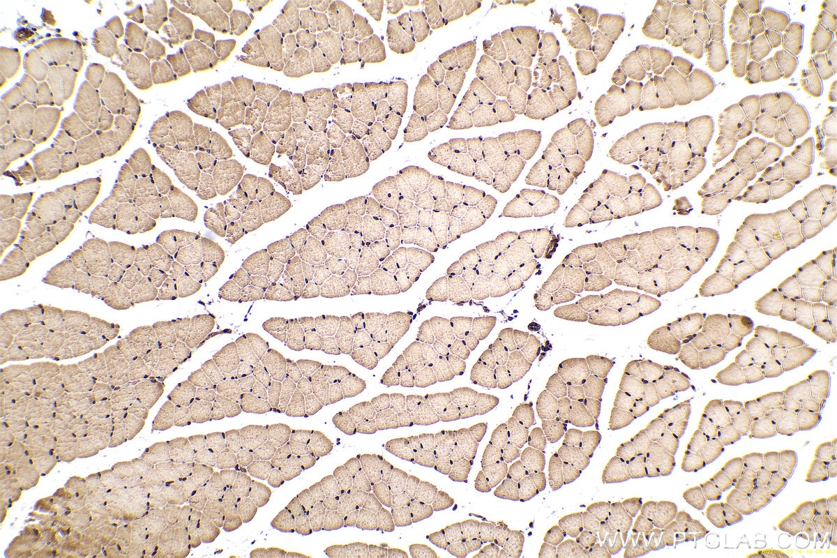 Immunohistochemical analysis of paraffin-embedded mouse skeletal muscle tissue slide using KHC0630 (LOX IHC Kit).