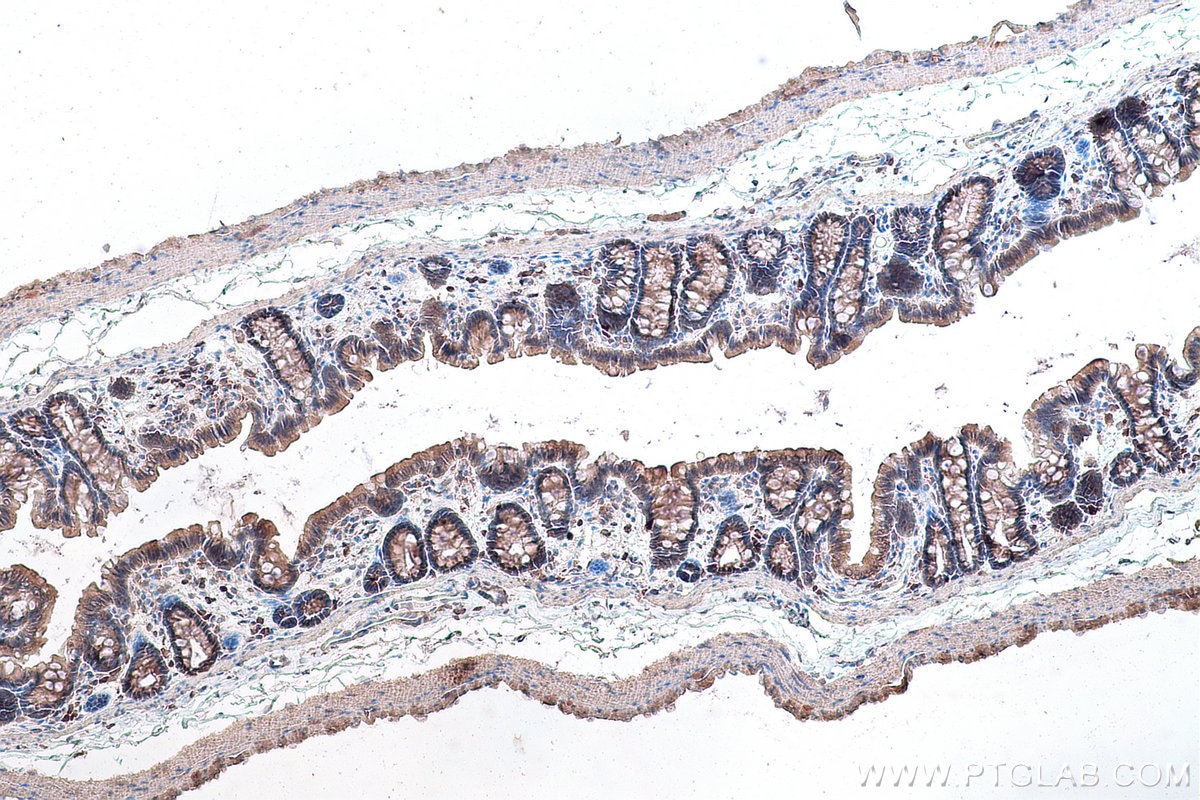 Immunohistochemical analysis of paraffin-embedded rat colon tissue slide using KHC0823 (LOXL2 IHC Kit).