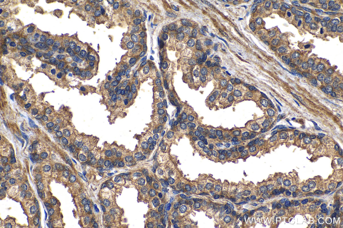 Immunohistochemical analysis of paraffin-embedded human prostate hyperplasia tissue slide using KHC1301 (LPAR3 IHC Kit).