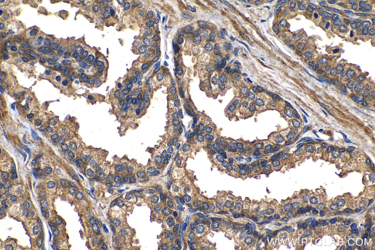 Immunohistochemical analysis of paraffin-embedded human prostate hyperplasia tissue slide using KHC1301 (LPAR3 IHC Kit).