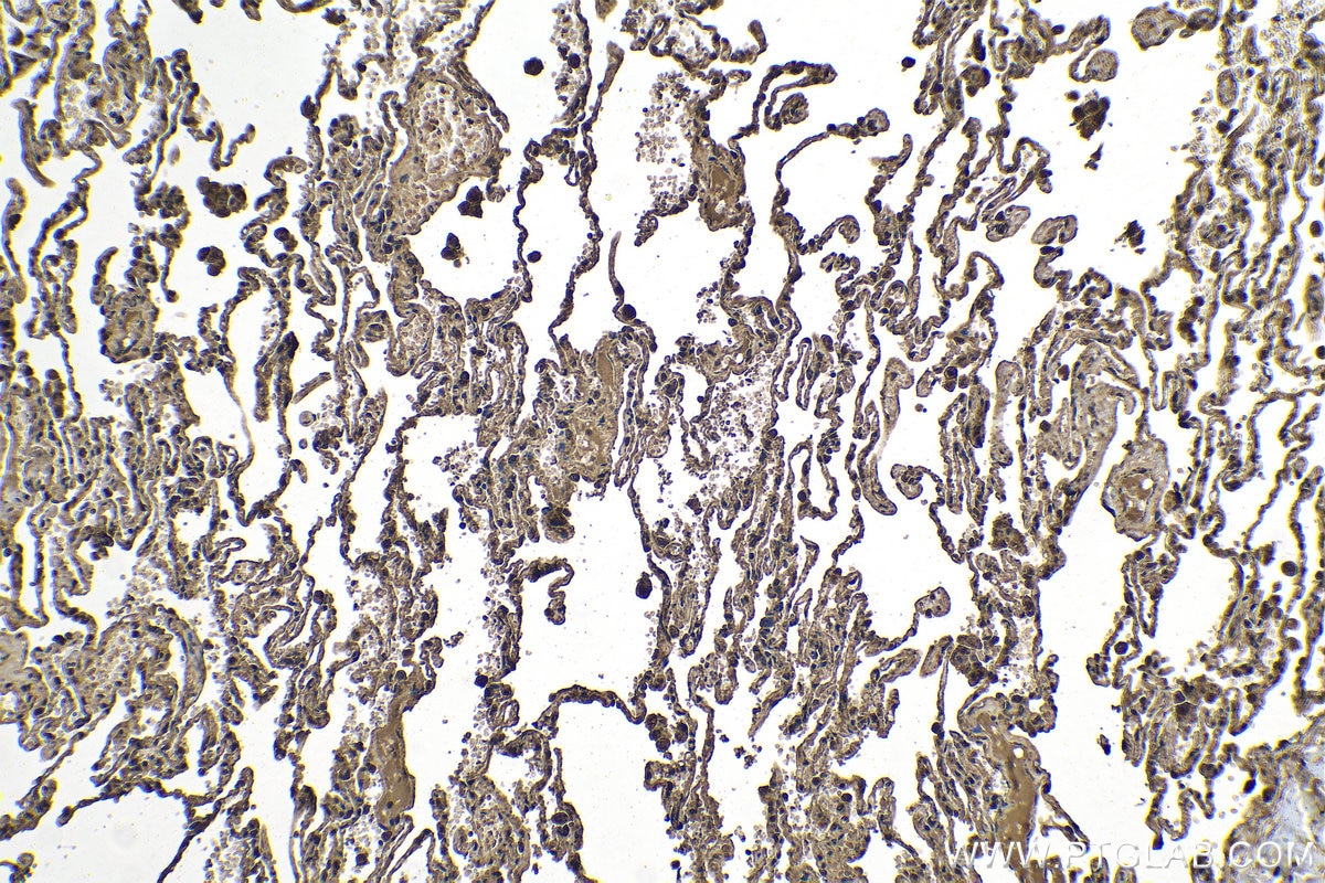 Immunohistochemical analysis of paraffin-embedded human lung tissue slide using KHC1301 (LPAR3 IHC Kit).