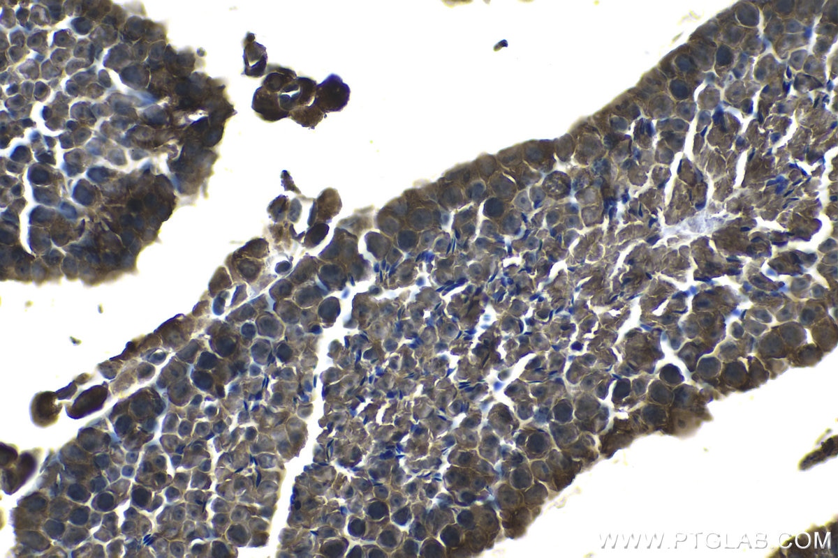 Immunohistochemical analysis of paraffin-embedded mouse testis tissue slide using KHC1301 (LPAR3 IHC Kit).