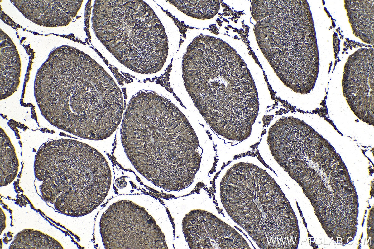 Immunohistochemical analysis of paraffin-embedded rat testis tissue slide using KHC1301 (LPAR3 IHC Kit).