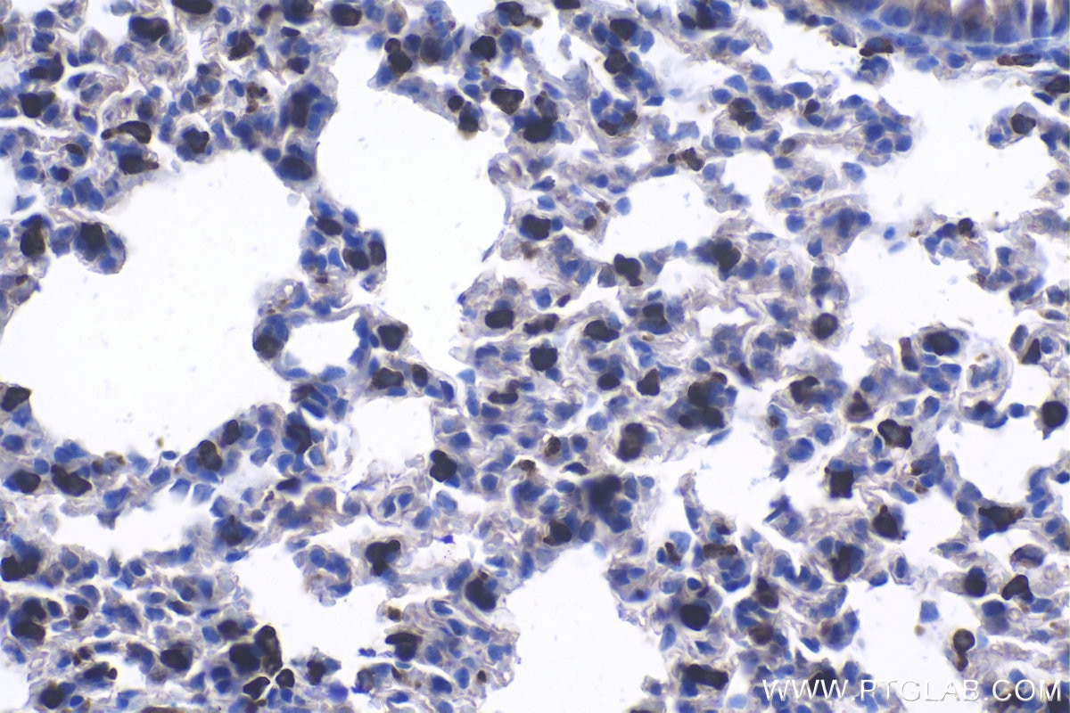 Immunohistochemical analysis of paraffin-embedded mouse lung tissue slide using KHC1097 (LPCAT1 IHC Kit).