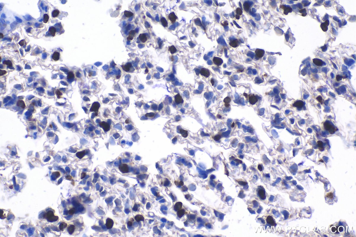 Immunohistochemical analysis of paraffin-embedded rat lung tissue slide using KHC1097 (LPCAT1 IHC Kit).