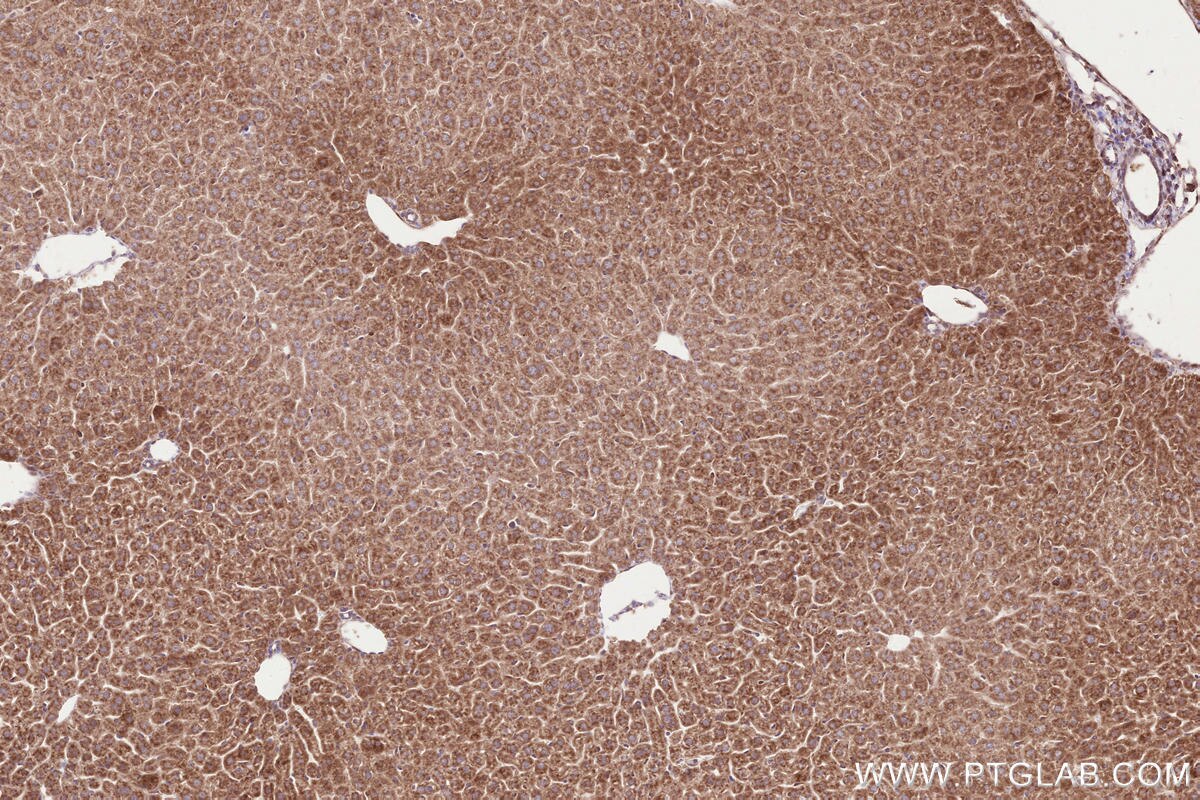 Immunohistochemical analysis of paraffin-embedded mouse liver tissue slide using KHC2585 (LPCAT3 IHC Kit).