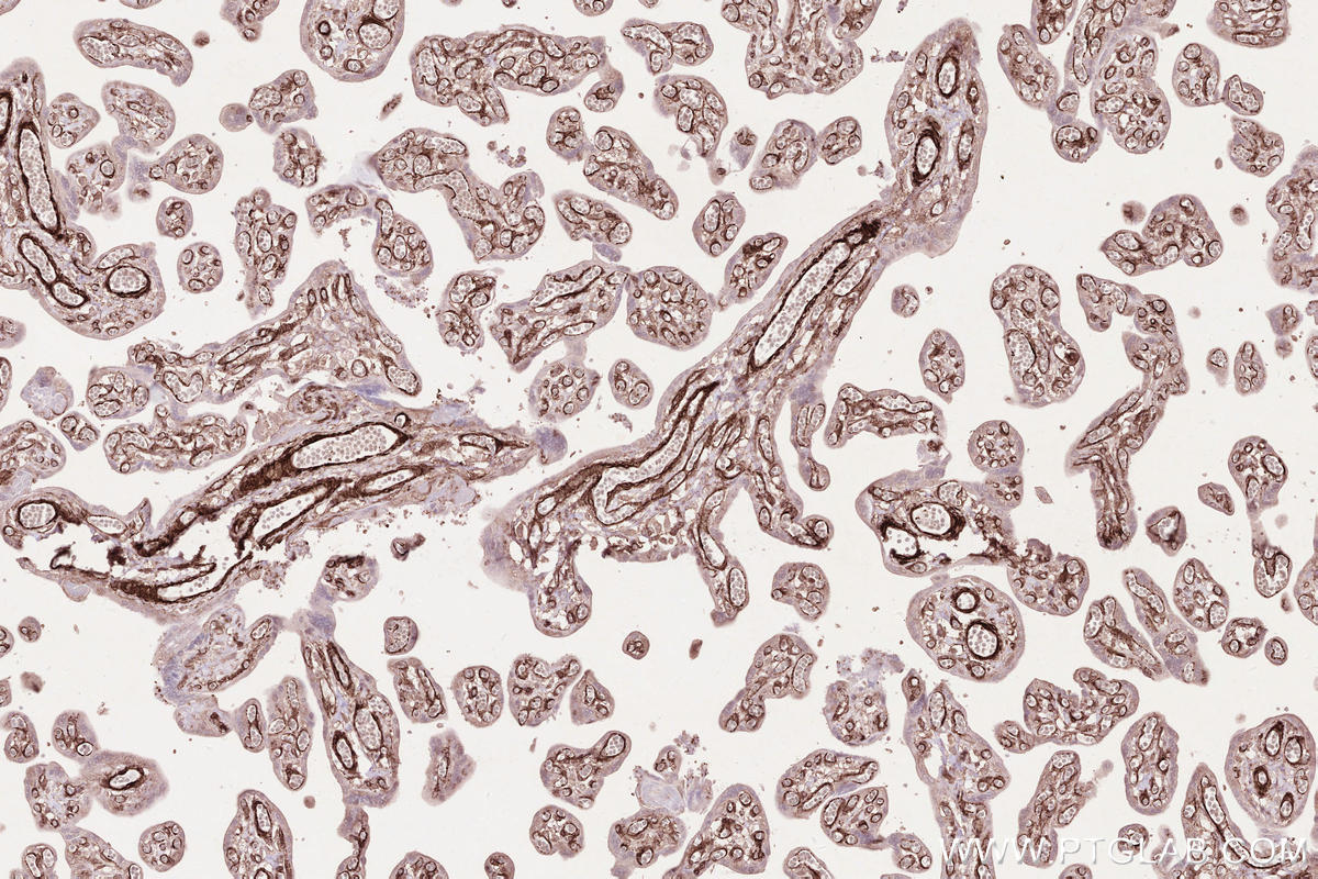 Immunohistochemical analysis of paraffin-embedded human placenta tissue slide using KHC2585 (LPCAT3 IHC Kit).