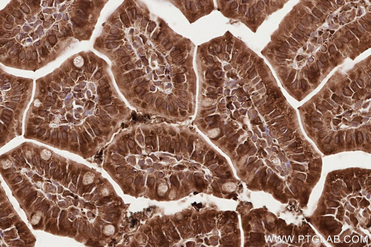 Immunohistochemical analysis of paraffin-embedded mouse small intestine tissue slide using KHC2570 (LPCAT4 IHC Kit).