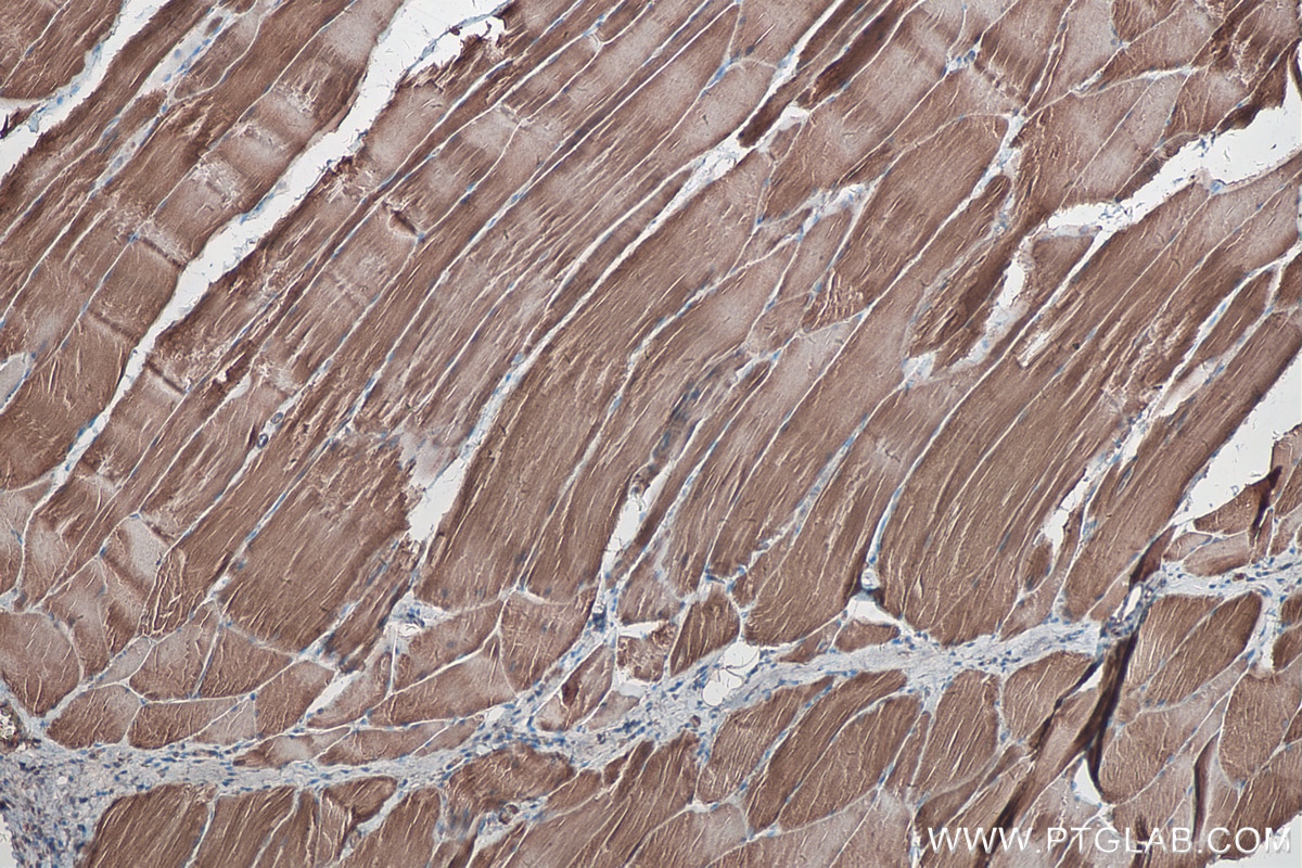 Immunohistochemical analysis of paraffin-embedded rat skeletal muscle tissue slide using KHC0302 (LPIN1 IHC Kit).