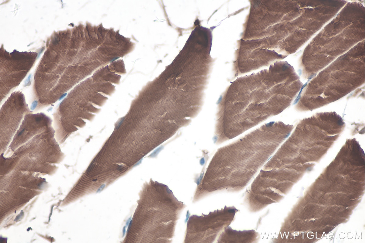 Immunohistochemical analysis of paraffin-embedded mouse skeletal muscle tissue slide using KHC0302 (LPIN1 IHC Kit).