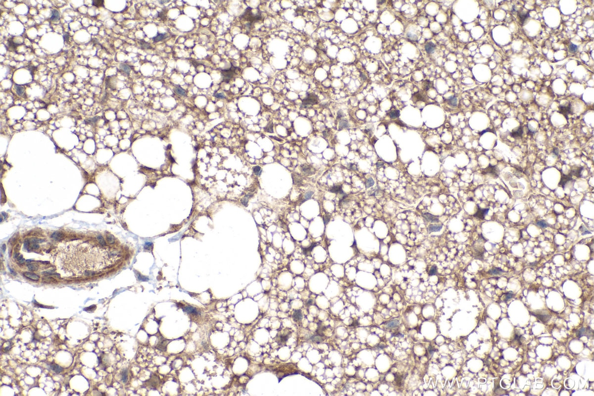 Immunohistochemical analysis of paraffin-embedded mouse brown adipose tissue slide using KHC0233 (LPL IHC Kit).