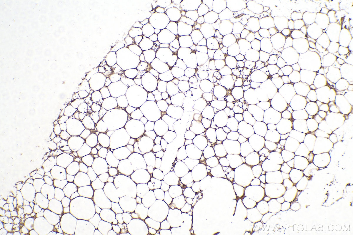 Immunohistochemical analysis of paraffin-embedded mouse brown adipose tissue slide using KHC0233 (LPL IHC Kit).