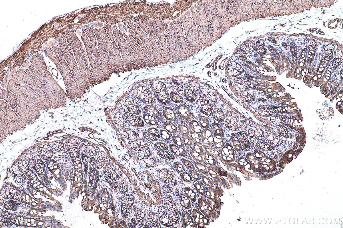 Immunohistochemical analysis of paraffin-embedded rat colon tissue slide using KHC0675 (LPP IHC Kit).