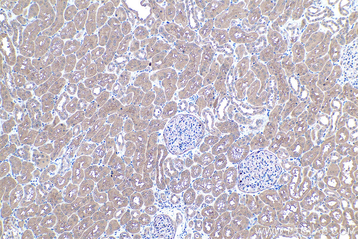 Immunohistochemical analysis of paraffin-embedded human kidney tissue slide using KHC0448 (LPPR2 IHC Kit).