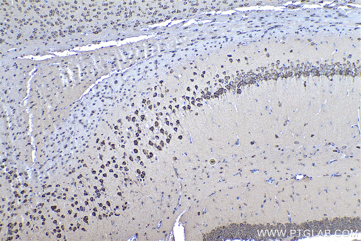 Immunohistochemical analysis of paraffin-embedded mouse brain tissue slide using KHC0448 (LPPR2 IHC Kit).