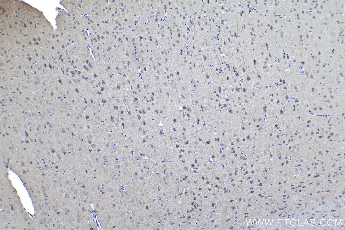 Immunohistochemical analysis of paraffin-embedded rat brain tissue slide using KHC0448 (LPPR2 IHC Kit).